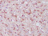 Anti-Human Cathepsin L Antibody - ABMIUM
