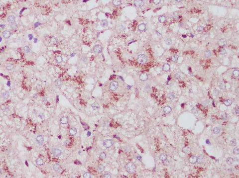 Anti-Human Cathepsin L Antibody - ABMIUM