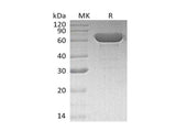 Recombinant Human Serum Albumin/HSA Protein - ABMIUM