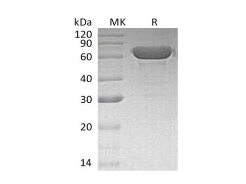 Recombinant Human Serum Albumin/HSA Protein - ABMIUM