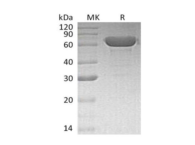 Recombinant Human Serum Albumin/HSA Protein - ABMIUM