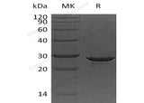 Recombinant Human Apolipoprotein A-I/ApoAI Protein (His Tag, E. coli) - ABMIUM