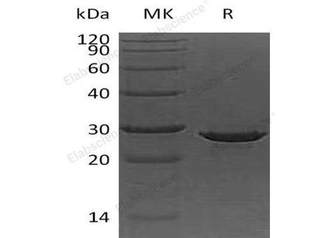 Recombinant Human Apolipoprotein A-I/ApoAI Protein (His Tag, E. coli) - ABMIUM
