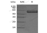 Recombinant Human Prostatic Acid Phosphatase/ACPP Protein (His Tag) - ABMIUM