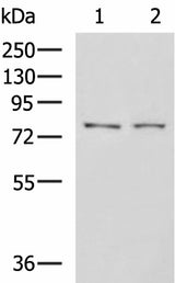 Western blot analysis of K562 cell Mouse liver tissue lysates using GPCPD1 Polyclonal Antibody at dilution of 1:650