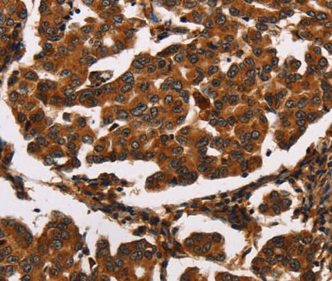 Anti-Human ARSB Antibody - ABMIUM