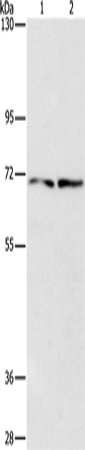 Anti-Human IFT74 Antibody - ABMIUM