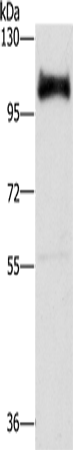 Anti-Human/Mouse/Rat DAB2 Antibody - ABMIUM