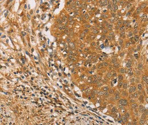 Anti-Human/Mouse/Rat ARMCX3 Antibody