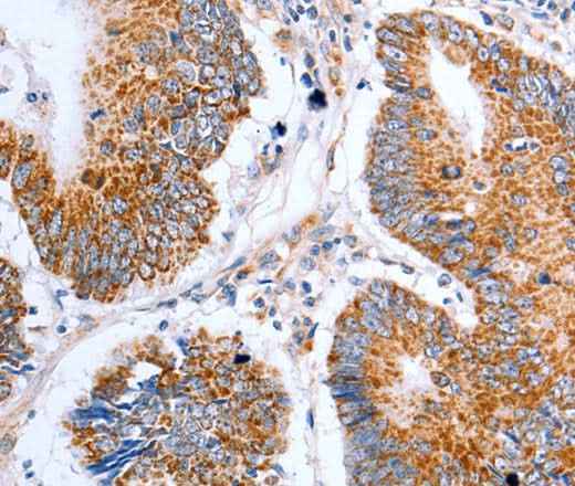 Anti-Human CLDN10 Antibody