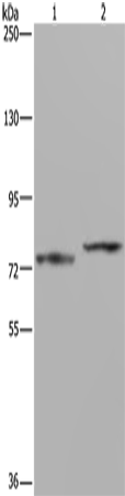 Anti-Human/Mouse/Rat AATF Antibody - ABMIUM