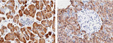 Anti-Human CPA2 Antibody [A1030] - ABMIUM