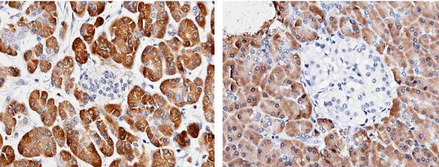 Anti-Human CPA2 Antibody [A1030] - ABMIUM