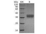 Recombinant Human AMBP/Alpha 1 Microglobulin Protein (His Tag) - ABMIUM