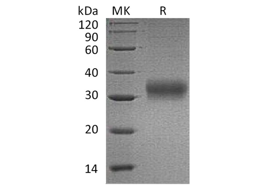 Recombinant Human AMBP/Alpha 1 Microglobulin Protein (His Tag) - ABMIUM
