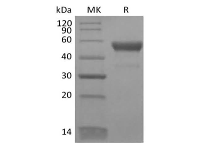 Recombinant Human CD300LB/LMIR5 (C-Fc) - ABMIUM