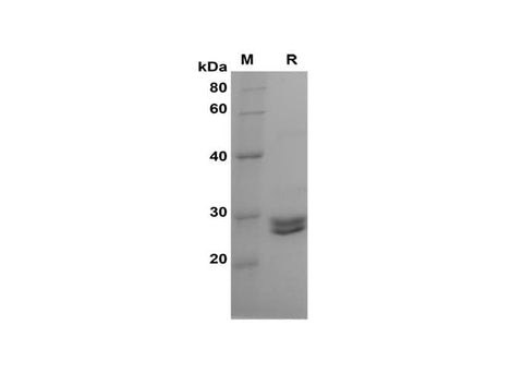 SDS-PAGE analysis of Mouse DNMT1 proteins, 2 μg/lane of Recombinant Mouse DNMT1 proteins was resolved with SDS-PAGE under reducing conditions, showing bands at 25-28 kDa.