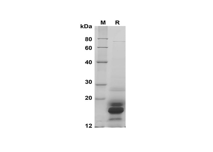 SDS-PAGE analysis of Human CSF2 proteins, 2 μg/lane of Recombinant Human CSF2 proteins was resolved with SDS-PAGE under reducing conditions, showing bands at 16 kDa.