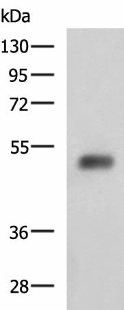 Western blot analysis of Human bladder transitional cell carcinoma grade 2-3 tissue lysate using SLC30A6 Polyclonal Antibody at dilution of 1:2000