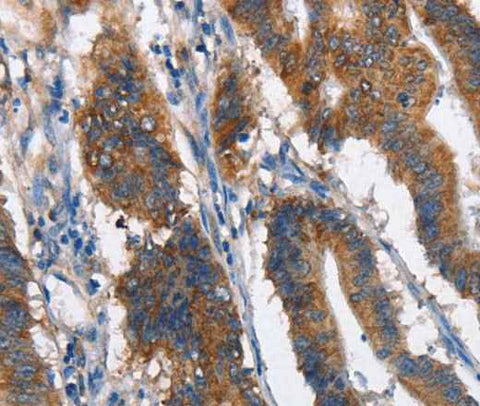 Anti-Human MAD2L1BP Antibody
