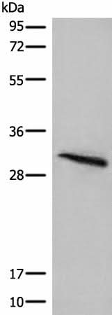 Western blot analysis of Mouse lung tissue lysate using ITM2B Polyclonal Antibody at dilution of 1:400