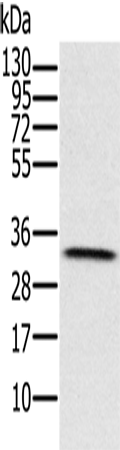 Anti-Human/Mouse/Rat HSD17B8 Antibody - ABMIUM