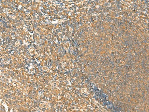 Immunohistochemistry of paraffin-embedded Human tonsil tissue using HTT Polyclonal Antibody at dilution of 1:25(×200)
