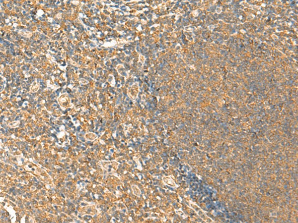 Immunohistochemistry of paraffin-embedded Human tonsil tissue using HTT Polyclonal Antibody at dilution of 1:25(×200)