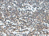 Immunohistochemistry of paraffin-embedded Human tonsil tissue using FAM107B Polyclonal Antibody at dilution of 1:150(×200)