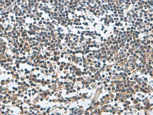 Anti-Human/Mouse/Rat FAM107B Antibody