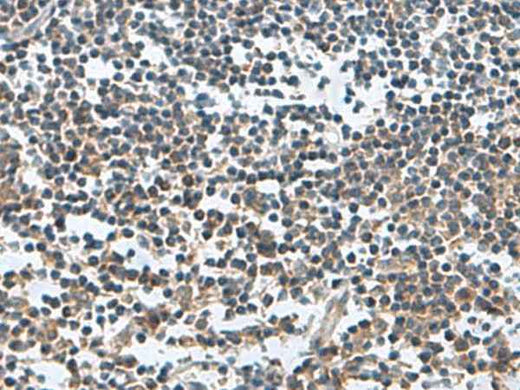 Anti-Human/Mouse/Rat FAM107B Antibody