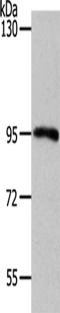 Anti-Human/Mouse MYSM1 Antibody - ABMIUM