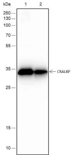 Anti-Rat/Mouse CRALBP Antibody [A194] - ABMIUM