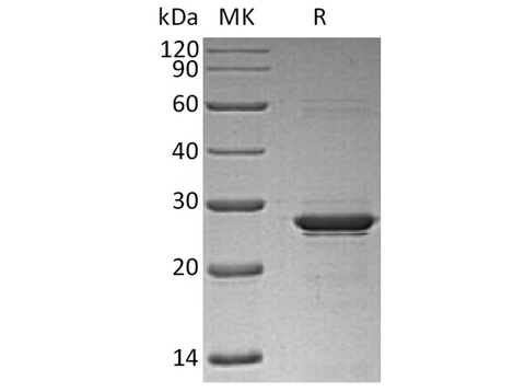 Recombinant Human Oncostatin M/OSM Protein (His Tag) - ABMIUM