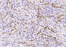Anti-Human ENG Antibody [A846] - ABMIUM