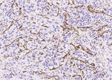Anti-Human ENG Antibody [A846] - ABMIUM