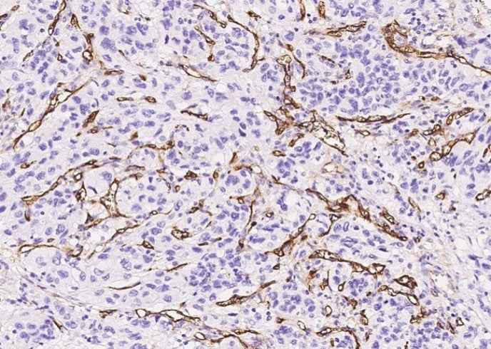 Anti-Human ENG Antibody [A846] - ABMIUM