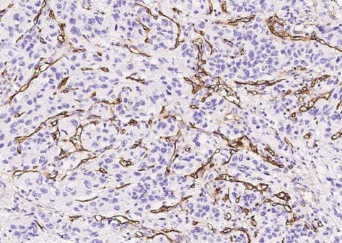 Anti-Human ENG Antibody [A846] - ABMIUM