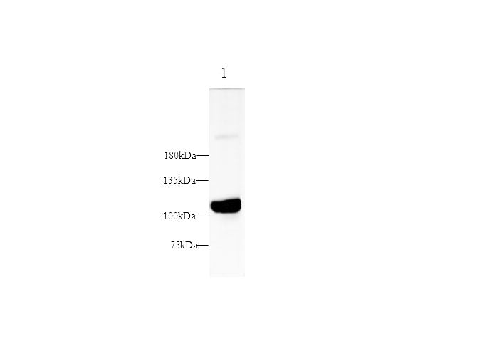 Anti-Human/Mouse/Rat PSMA Antibody - ABMIUM