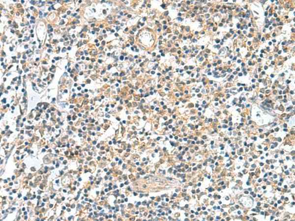 Anti-Human/Mouse GEMIN7 Antibody