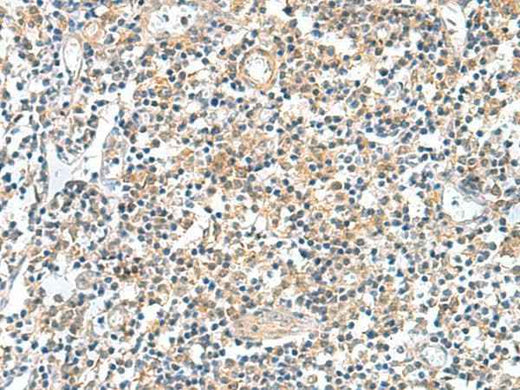 Immunohistochemistry of paraffin-embedded Human tonsil tissue using GEMIN7 Polyclonal Antibody at dilution of 1:50(×200)