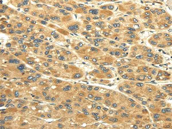 Anti-Human/Mouse UACA Antibody