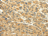 Anti-Human/Mouse UACA Antibody - ABMIUM