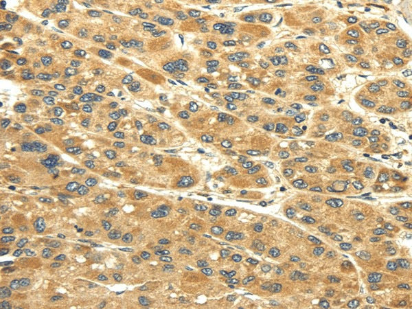 Anti-Human/Mouse UACA Antibody - ABMIUM