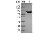 Recombinant Human F13a/Factor XIIIa Protein (His Tag) - ABMIUM
