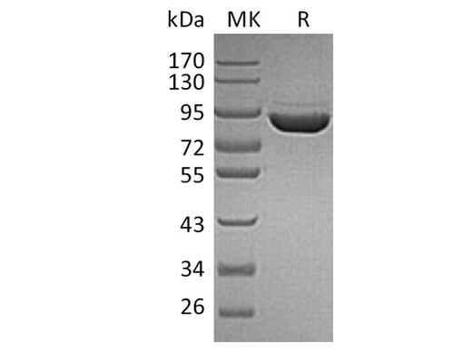 Recombinant Human F13a/Factor XIIIa Protein (His Tag) - ABMIUM
