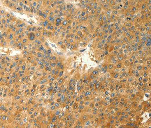 Anti-Human/Mouse/Rat RAB35 Antibody