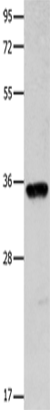 Anti-Human/Mouse COX11 Antibody - ABMIUM