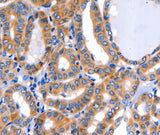 Anti-Human/Mouse/Rat GFER Antibody - ABMIUM