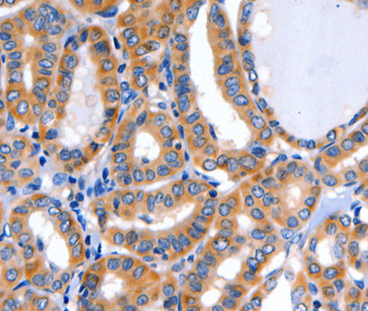 Anti-Human/Mouse/Rat GFER Antibody - ABMIUM